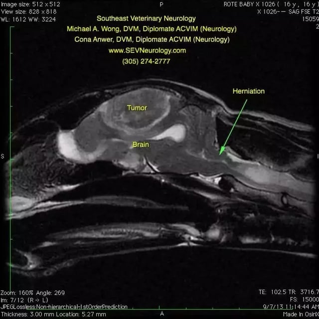 Baby-MRI1-square-