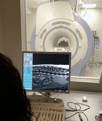 MRI at SEVN