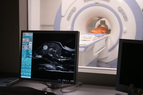 MRI scan of Brinkley's brain