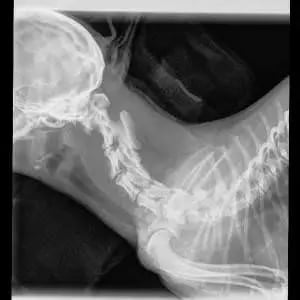 Radiograph-Pre-op - Luna bell