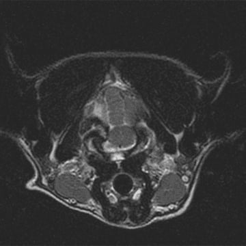 case-study-milo-mri-2-1