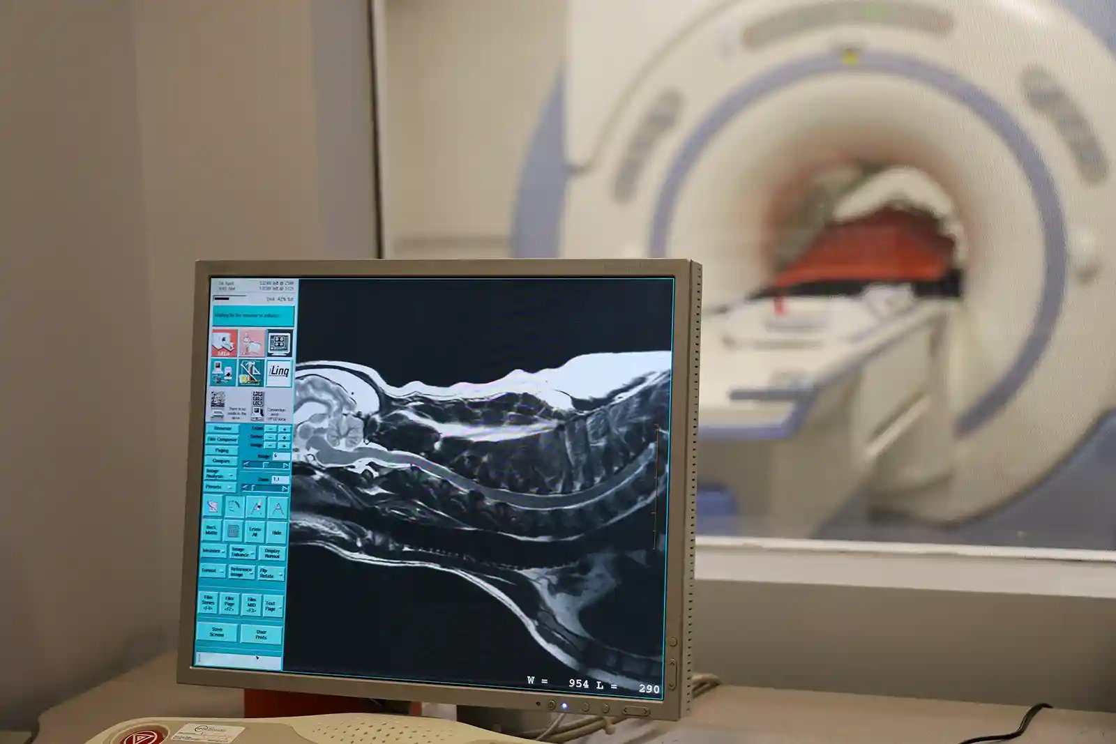 A clear and detailed image of a slipped disc from a pet MRI