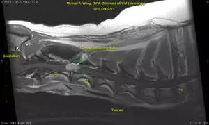 Hurcules-Sagittal