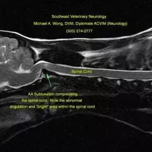 Atlantoaxial-luxation-mri-square